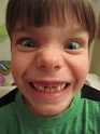 Alex_LooseTooth (2)